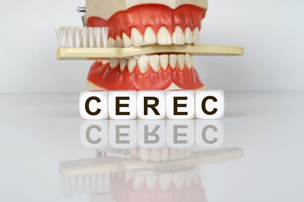 Are CEREC Crowns Stronger Than Traditional Ones?