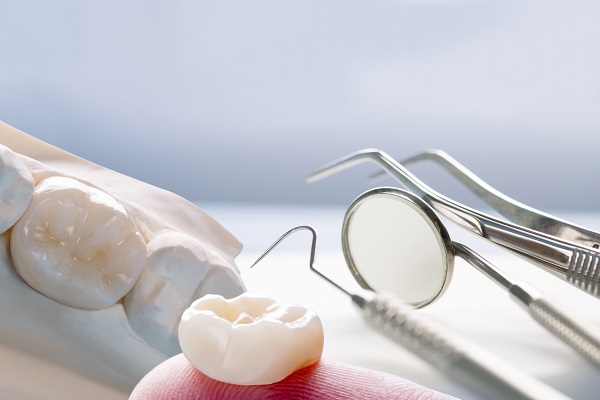 Tips For Dental Crown Aftercare