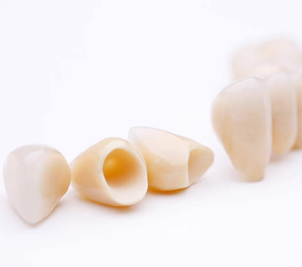 Draper Dental Crowns and Dental Bridges