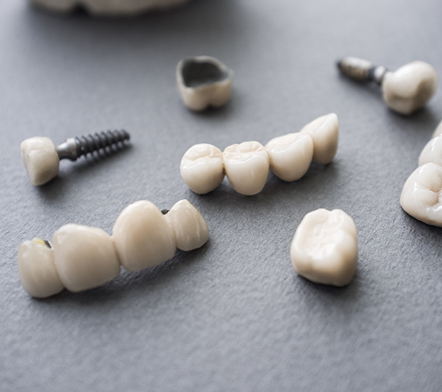 Draper The Difference Between Dental Implants and Mini Dental Implants