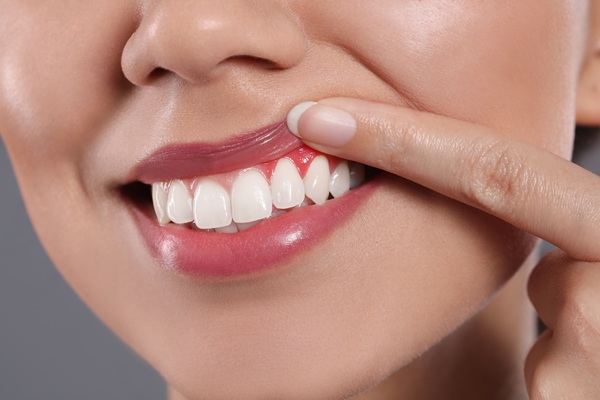 LANAP Laser Dentist Vs  Traditional Gum Surgery: What Patients Need To Know