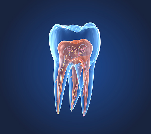 Draper What is an Endodontist